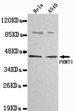 PRMT1 Monoclonal Antibody (8A8)