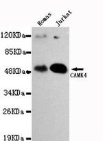 CaMKIV Monoclonal Antibody (7B8)