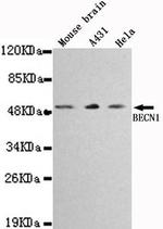 Beclin 1 Monoclonal Antibody (8A8)