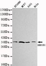 AKR1B1 Monoclonal Antibody (2A10)
