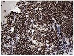 SMC1 Antibody in Immunohistochemistry (Paraffin) (IHC (P))