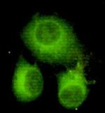 ATP Citrate Lyase Monoclonal Antibody (3A10)