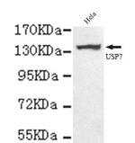 USP7 Antibody in Western Blot (WB)