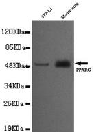 PPAR gamma Monoclonal Antibody (7E11)
