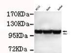 HK2 Monoclonal Antibody (7E7)