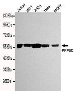 PP5 Monoclonal Antibody (2A9)