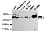 SAFB Antibody in Western Blot (WB)