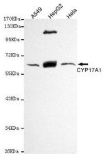CYP17A1 Monoclonal Antibody (3C10)
