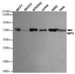 IGF2BP3 Monoclonal Antibody (8B7)