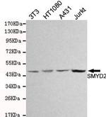 SMYD2 Monoclonal Antibody (8E5)