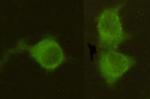 MPI Antibody in Immunocytochemistry (ICC/IF)