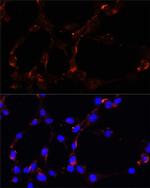 VDAC Antibody in Immunocytochemistry (ICC/IF)