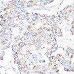 VDAC Antibody in Immunohistochemistry (IHC)