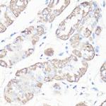 VDAC Antibody in Immunohistochemistry (IHC)