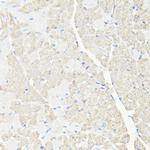 VDAC Antibody in Immunohistochemistry (IHC)