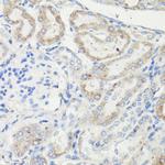 VDAC Antibody in Immunohistochemistry (IHC)