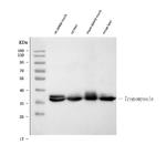 TPM1 Monoclonal Antibody (TM31)