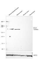 MYH7 Antibody in Western Blot (WB)