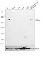 MYH7 Antibody in Western Blot (WB)