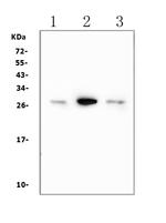 Calbindin D28K Antibody in Western Blot (WB)