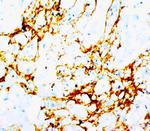 TNN Monoclonal Antibody (BC-24)