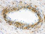 ACTA1 Antibody in Immunohistochemistry (Frozen) (IHC (F))