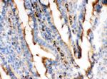 ACTA1 Antibody in Immunohistochemistry (Frozen) (IHC (F))