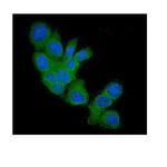 FHIT Monoclonal Antibody (26H7)