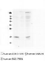 FHIT Antibody in Western Blot (WB)