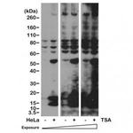 Acetylated Lysine Antibody in Western Blot (WB)