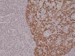 Cytokeratin 14 Antibody in Immunohistochemistry (Paraffin) (IHC (P))
