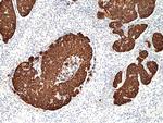 Cytokeratin 14 Recombinant Rabbit Monoclonal Antibody (RM328)