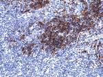 TdT Recombinant Rabbit Monoclonal Antibody (RM379)