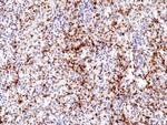CD61 (Integrin beta 3) Recombinant Rabbit Monoclonal Antibody (RM382)