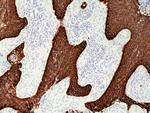 Cytokeratin 5/6 Recombinant Rabbit Monoclonal Antibody (RM341)