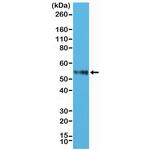 CD4 Antibody in Western Blot (WB)