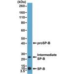 SFTPB Precursor Antibody in Western Blot (WB)