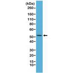 Cytokeratin 7 Recombinant Rabbit Monoclonal Antibody (RM284)
