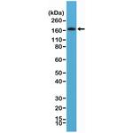 PDGFRB Antibody in Western Blot (WB)