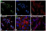 Androgen Receptor Recombinant Rabbit Monoclonal Antibody (RM254)