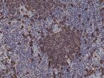 CD20 Antibody in Immunohistochemistry (Paraffin) (IHC (P))