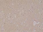 CD56 (NCAM) Recombinant Rabbit Monoclonal Antibody (RM315)