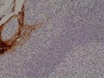 Cytokeratin 4 Recombinant Rabbit Monoclonal Antibody (RM355)