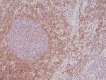 CD5 Antibody in Immunohistochemistry (Paraffin) (IHC (P))