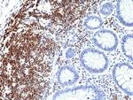 CD5 Antibody in Immunohistochemistry (Paraffin) (IHC (P))