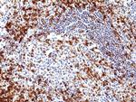 CD5 Antibody in Immunohistochemistry (Paraffin) (IHC (P))