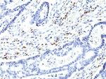 CD5 Antibody in Immunohistochemistry (Paraffin) (IHC (P))