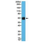 CD5 Antibody in Western Blot (WB)