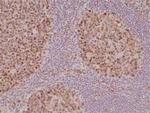 Stathmin 1 Recombinant Rabbit Monoclonal Antibody (RM350)