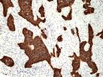 Cytokeratin 5 Recombinant Rabbit Monoclonal Antibody (RM226)
